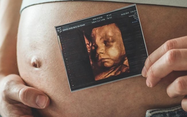 Ultrassonografia obstétrica avança no diagnóstico pré-natal
