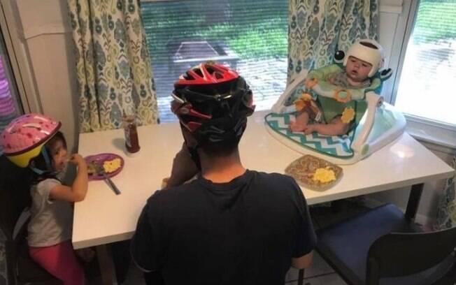 Família usa capacete diariamente para apoiar bebê com plagiocefalia, condição que deforma o crânio da criança