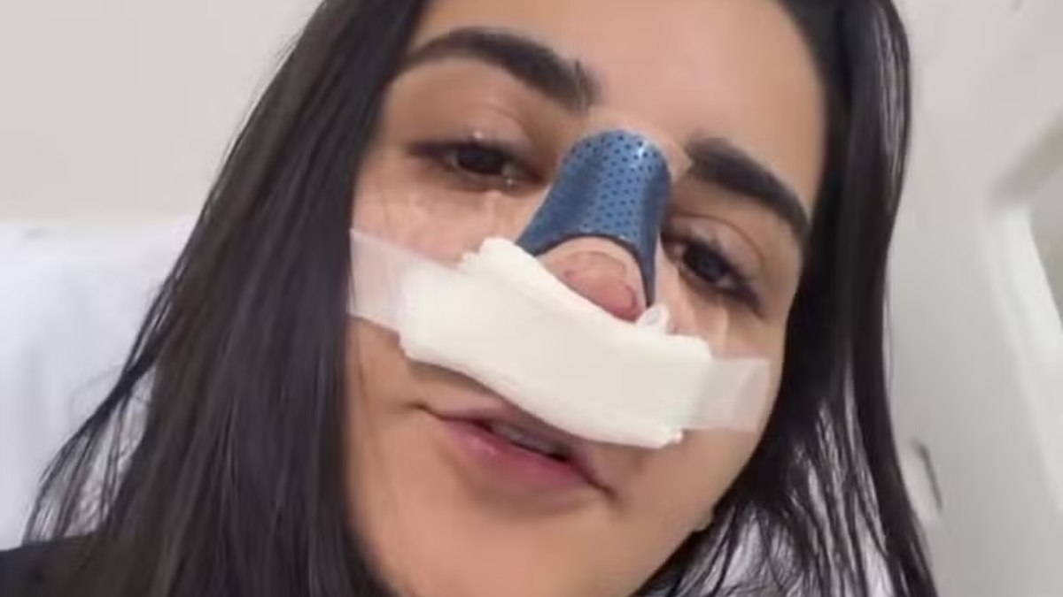 Yasmin Santos Choca Fãs com Resultado da Rinoplastia: 'Sou Outra Pessoa'!