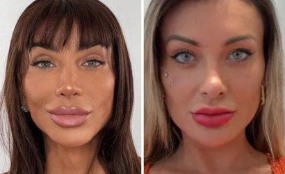 Massafera e outros artistas que mudaram a cor dos olhos