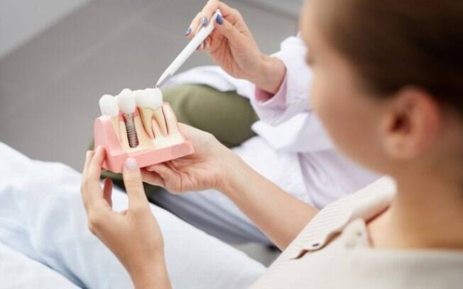 Popularização do acesso a implantes dentários promove mudanças em saúde bucal