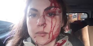 Procurador que espancou chefe volta a receber salário de R$ 7 mil