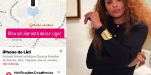 Atriz famosa reage a assalto e sofre ferimentos no rosto