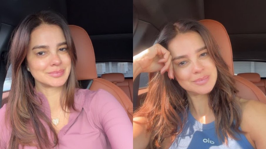 Vera Viel fala sobre complicações na perna após cirurgia Vera Viel fala sobre complicações na perna após cirurgia