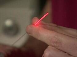 Terapia com laser cura metade dos pacientes de câncer de próstata