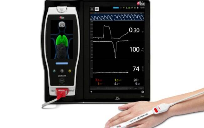 Os pesquisadores usam o ndice de reserva de oxignio Masimo ORi para ajudar a suprimir a hiperxia ps-operatria em pacientes submetidos  cirurgia de mama