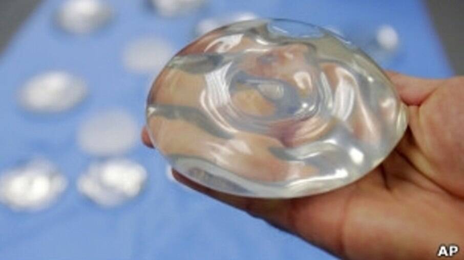 O Implante de silicone tradicional costuma-ser necessário ser trocada a cada 10 ou 25 anos 