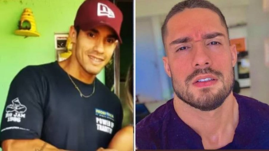 Bil Araújo comenta o antes e depois de harmonização facial