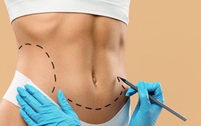 Beleza natural é foco da cirurgia plástica em 2025 Beleza natural é foco da cirurgia plástica em 2025
