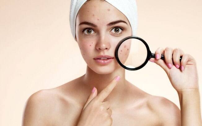 Mapa das espinhas: saiba o que significa a acne em cada área do rosto