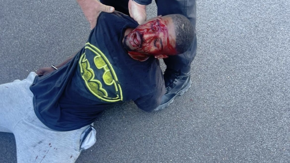 Fotos compartilhadas nas redes sociais mostram que Brandon ficou ensanguentado após a abordagem policial