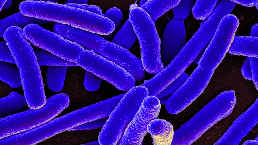 Bactéria Escherichia coli (E. coli) Bactéria Escherichia coli (E. coli)