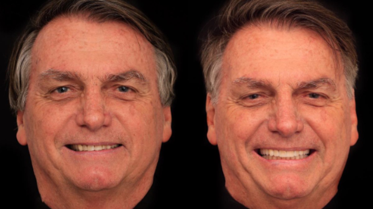 Antes e depois do sorriso de Bolsonaro