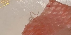 Verme vivo aparece em sashimi e revolta cliente de restaurante