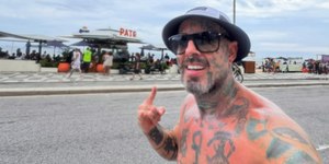 Tico Santa Cruz fala sobre vício em açúcar: “Perdendo o controle”