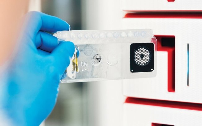 ANS inclui teste para meningite e encefalite no rol ANS inclui teste para meningite e encefalite no rol