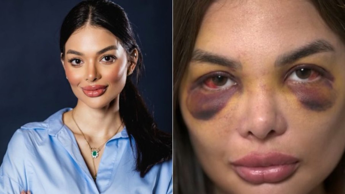 "Ia morrer ali", conta mulher agredida por empresário em SP - QTU Questões do Universo