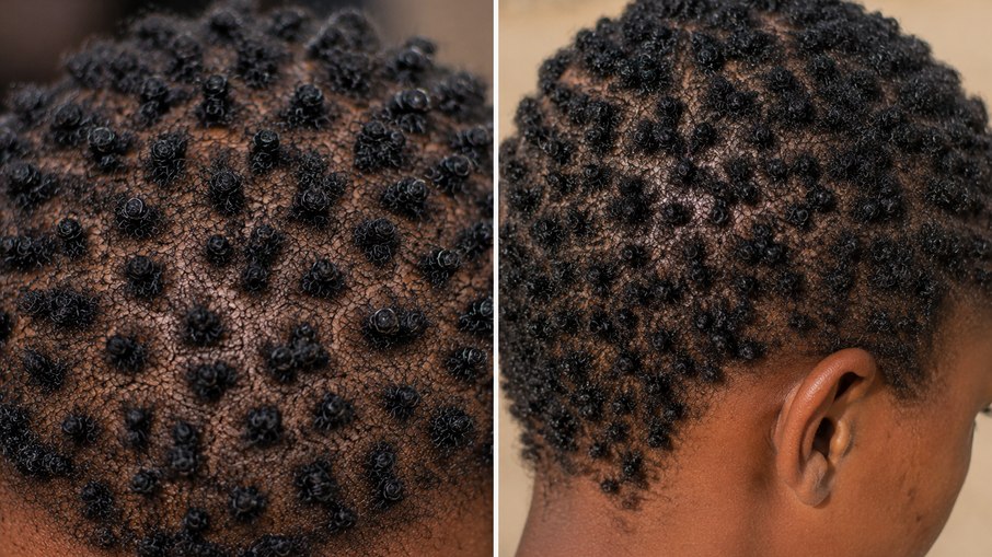 O cabelo raro africano que parece feito de “pontos”