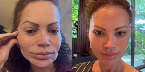 Solange Almeida mostra resultado de lifting facial: “Nova fase”