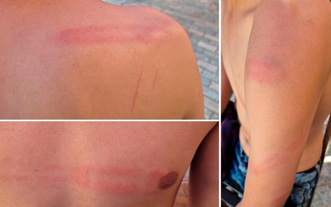 Jovem denuncia agressão em centro de recuperação no bairro Água Branca