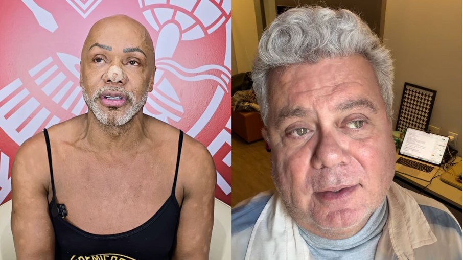 Coreógrafo de Samba Pede Desculpas a Milton Cunha Após Declarações Controversas