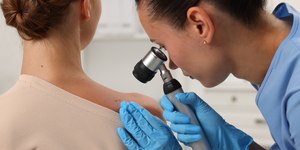 Câncer de pele cresce no Brasil e reforça a prevenção
