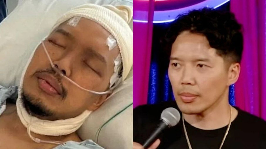 Alex Duong morre no final de semana após 1 ano de luta