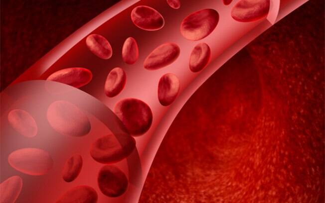 Iniciada consulta pública para incorporação de tratamento de hemofilia A no SUS