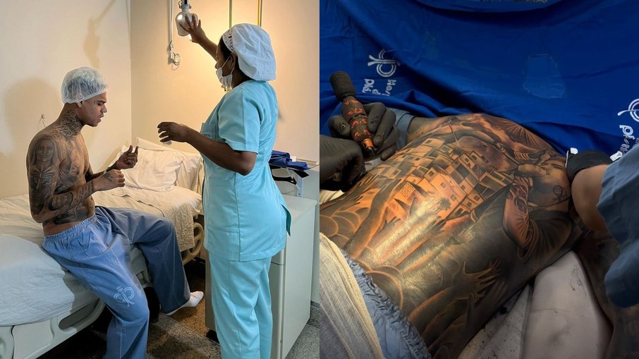 MC Cabelinho tomou anestesia geral para fazer tatuagem