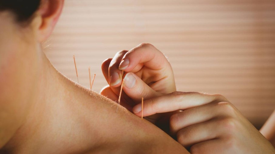 Conheça os benefícios da acupuntura para a saúde feminina
