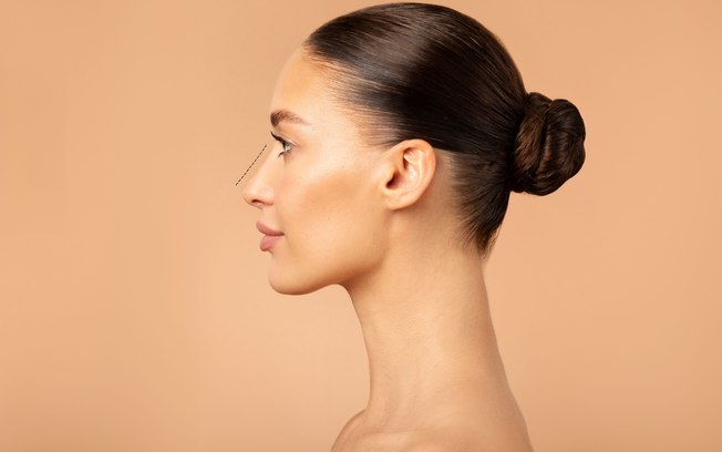 Rinoplastia ultrassônica gera avanços na estética facial