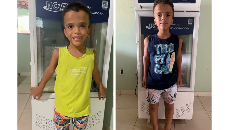 Evolução do Cauã com o tratamento da vosoritida