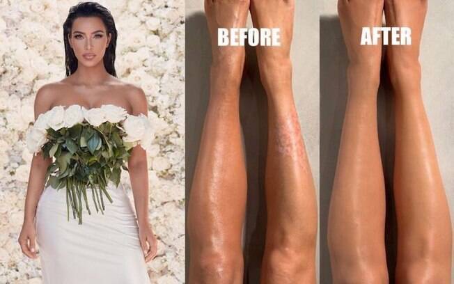 Kim Kardashian mostrou o que faz para disfarçar inflamações na pele