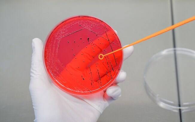 O estudo definiu o grau de resistência aos antibióticos de cada uma das 90 amostras O estudo definiu o grau de resistência aos antibióticos de cada uma das 90 amostras