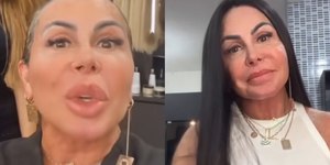 Vídeo de Gretchen careca colocando megahair viraliza na web; veja antes e depois