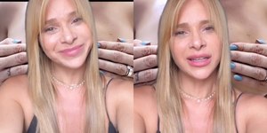 Dany Bananinha passa por cirurgia após complicações com silicone: 'Explodiu'