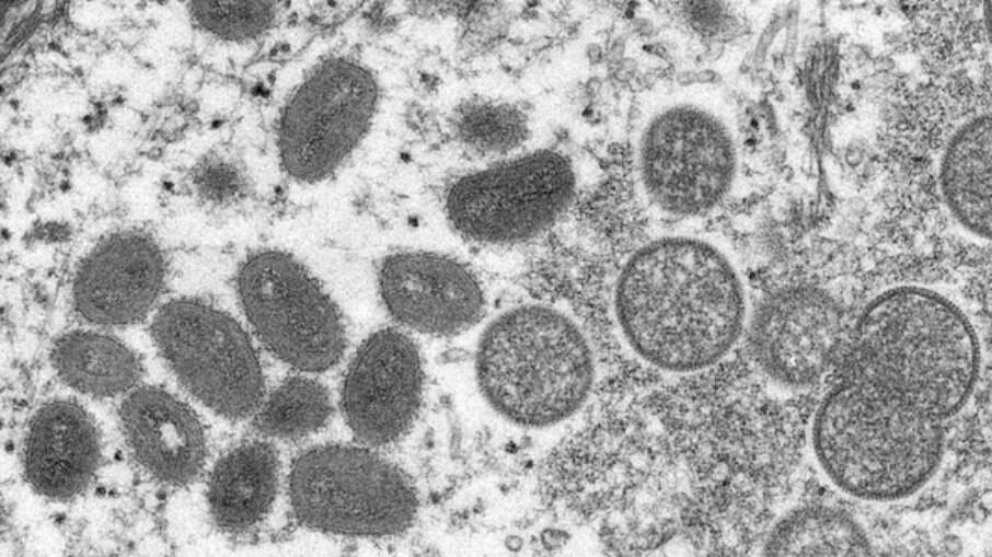 Vírus da 'varíola dos macacos'