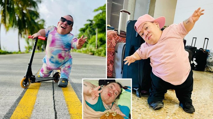 Influenciador com nanismo morre aos 33 anos com doença genética