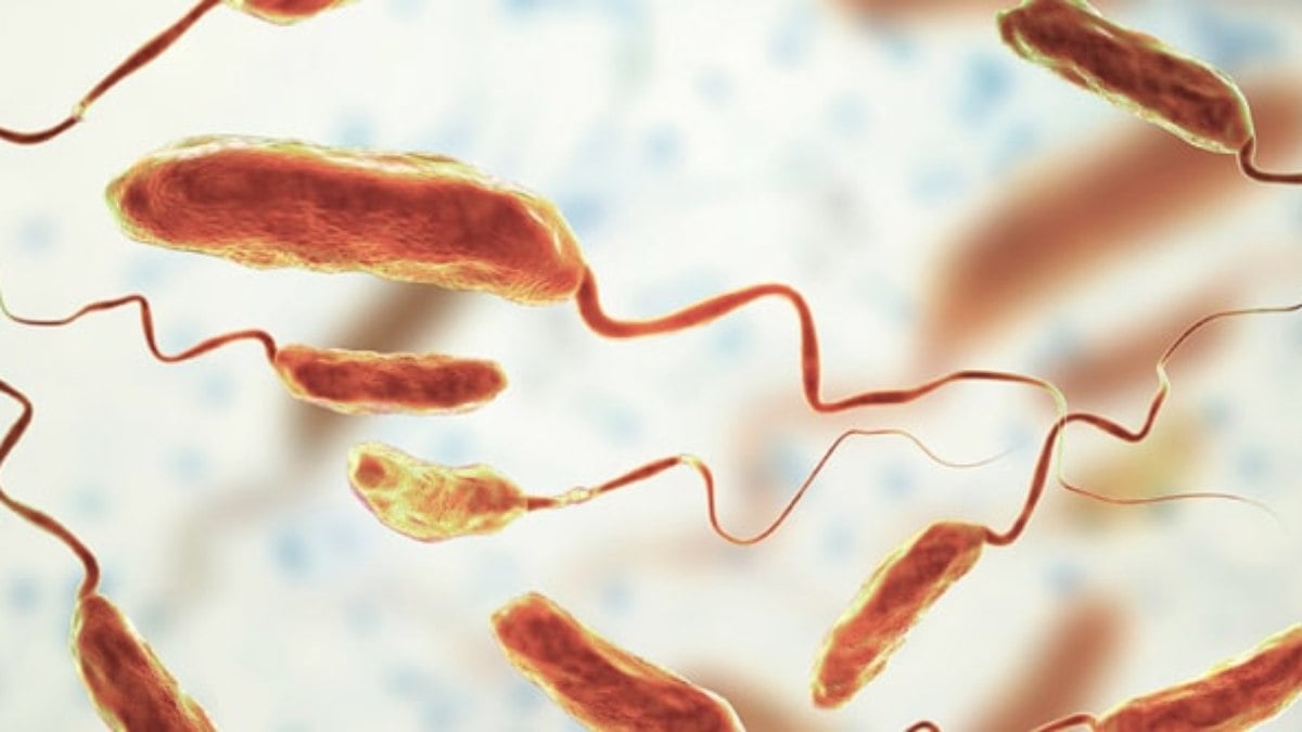 A cólera é uma doença que afeta o intestino delgado e é causada pela bactéria Vibrio cholerae,