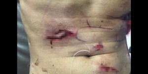 Pescador sofre ataque de crocodilo na Malásia