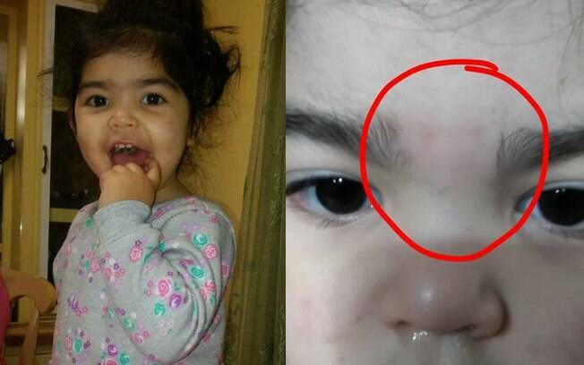 A mãe publicou um post no Facebook acusando uma funcionária da creche de ter depilado as sobrancelhas da filha 