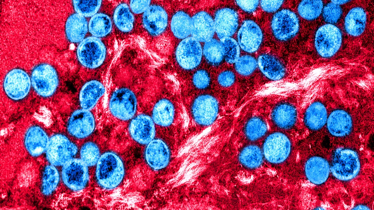 Mpox: entenda a nova doença que ameaça o mundo