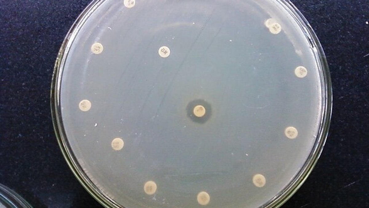 Superbactéria resistente a antibiótico Superbactéria resistente a antibiótico