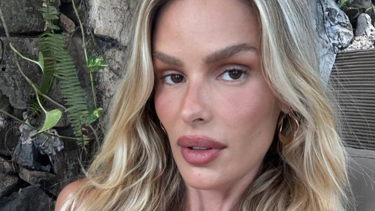 Yasmin Brunet mostra mudança após perder 14 kg ao tratar lipedema