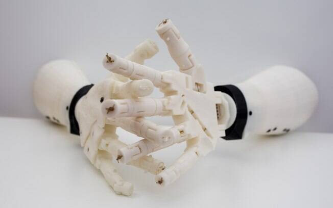 Próteses de silicone feitas de impressão 3D já são utilizadas em muitos pacientes amputados, na área da ortopedia
