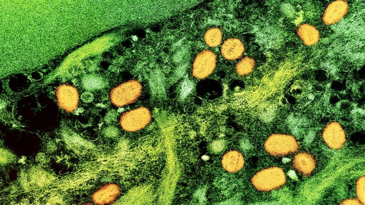 Micrografia eletrônica de transmissão colorida de partículas do vírus da varíola dos macacos (amarelo) encontradas dentro de uma célula infectada (verde), cultivadas em laboratório