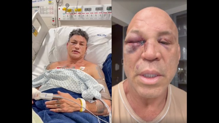 Guerra de versões: o que as equipes de Popó e Wanderlei disseram