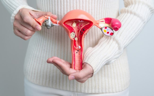 Endometriose severa: cirurgia robótica pode reduzir dor e riscos