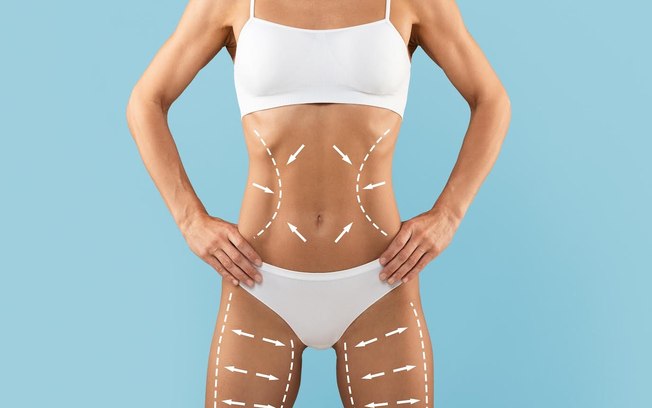 Avanços tecnológicos ampliam resultados da lipoaspiração