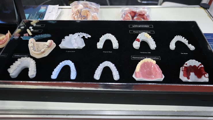 Odontologia digital acelera entrega de próteses no SUS